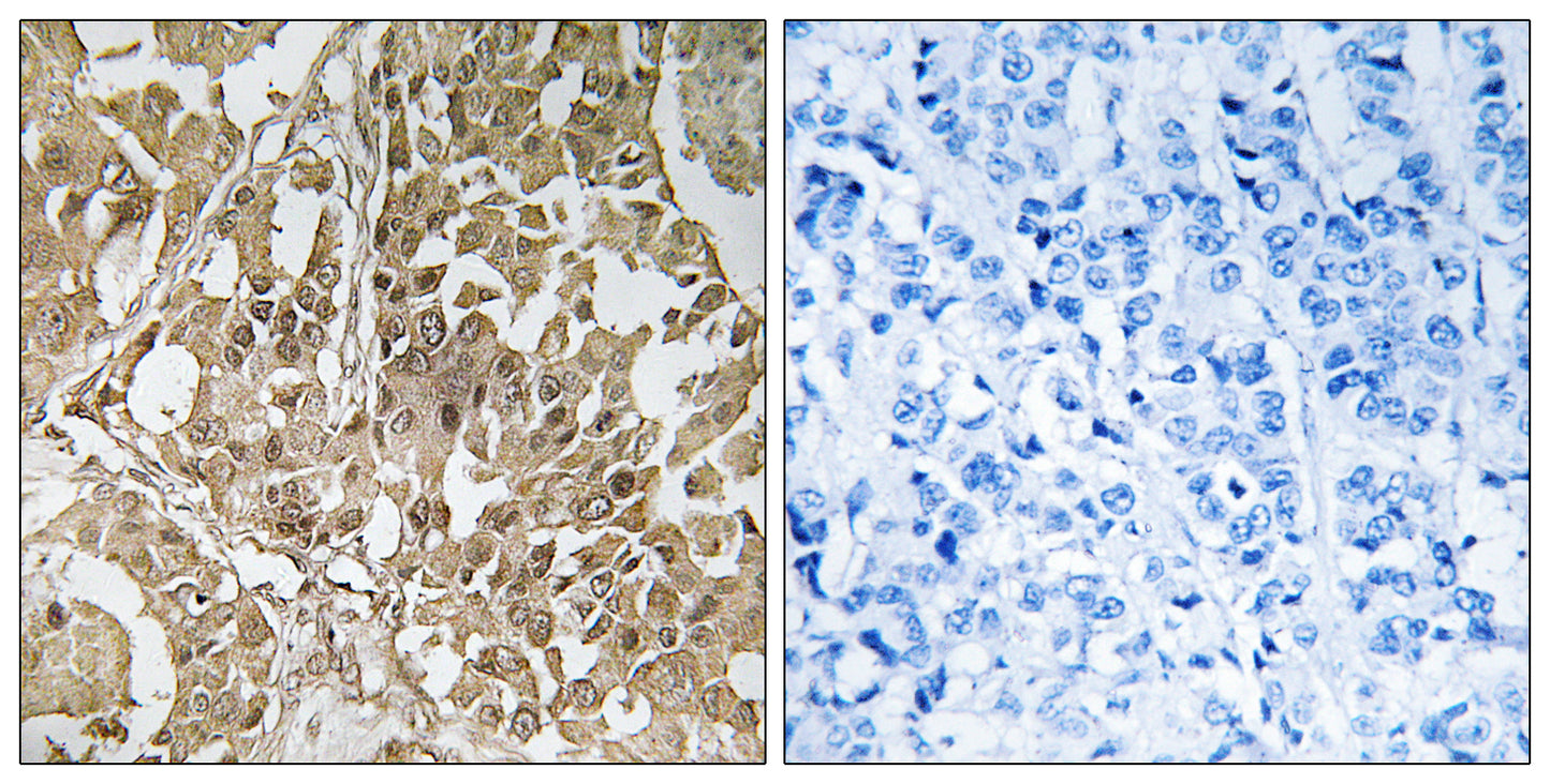 Bub1 Rabbit Polyclonal Antibody