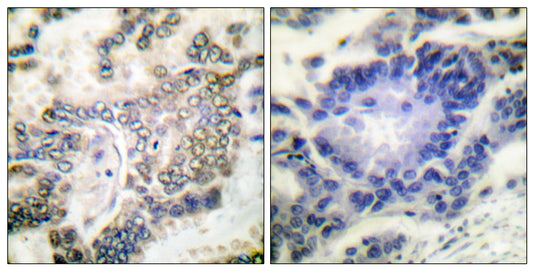 C/EBP α Rabbit Polyclonal Antibody