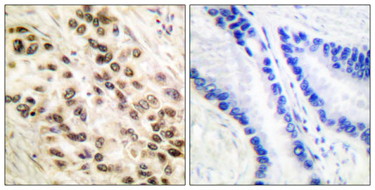 C/EBP β Rabbit Polyclonal Antibody