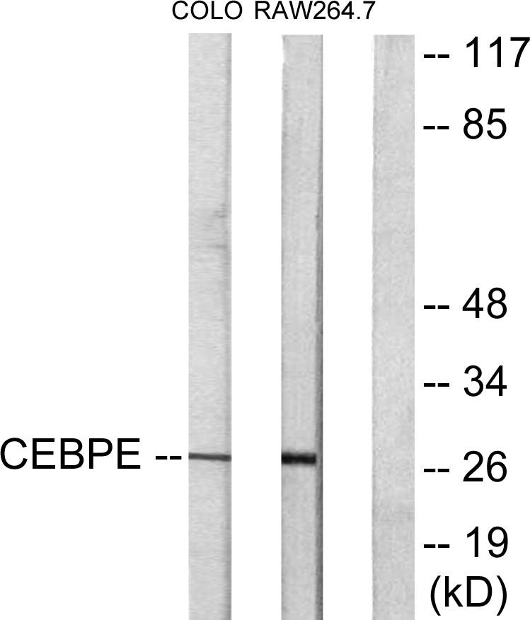 C/EBP δ/ε Rabbit Polyclonal Antibody
