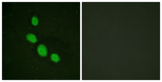 C/EBP ε Rabbit Polyclonal Antibody