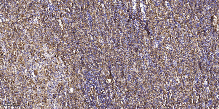 C16orf44 Rabbit Polyclonal Antibody
