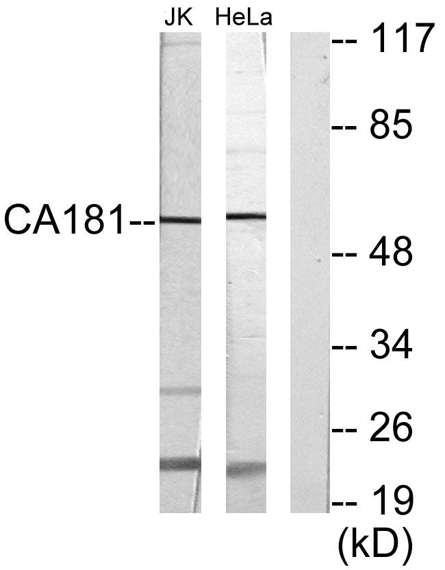 C1orf181 Rabbit Polyclonal Antibody