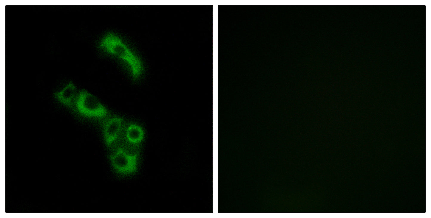 C1q-B Rabbit Polyclonal Antibody