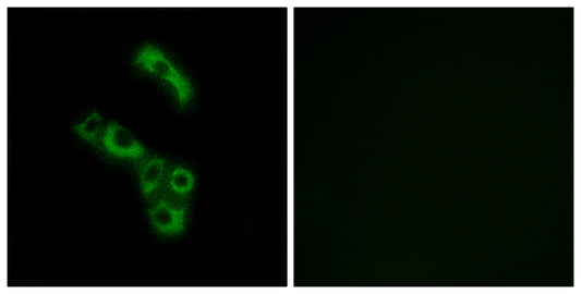 C1q-B Rabbit Polyclonal Antibody
