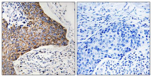 C1QBP Rabbit Polyclonal Antibody
