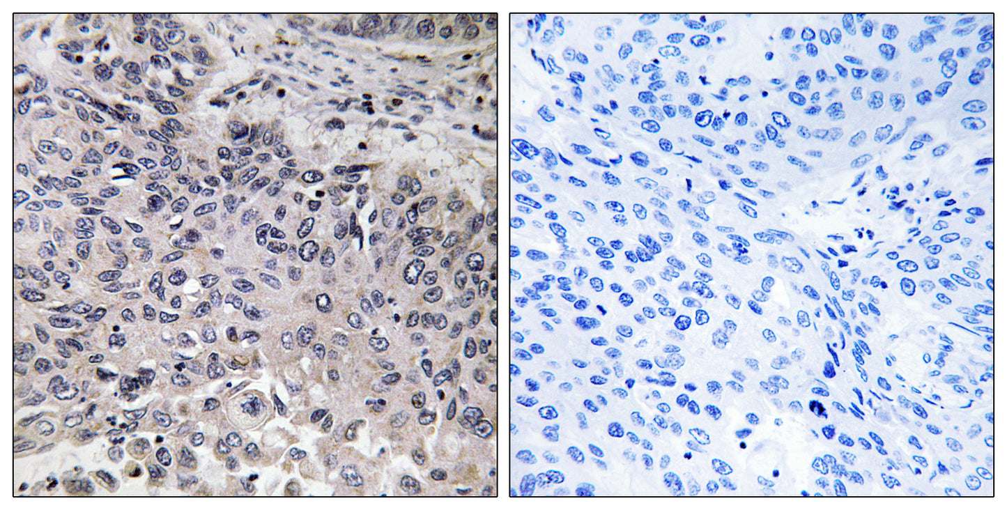 C1q-C Rabbit Polyclonal Antibody