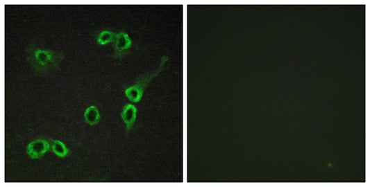 C3aR Rabbit Polyclonal Antibody