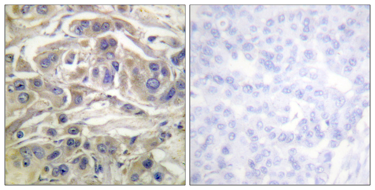 C3G Rabbit Polyclonal Antibody
