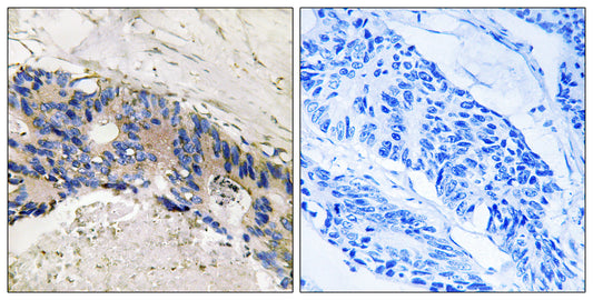 CA I Rabbit Polyclonal Antibody