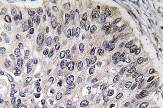 CA II Rabbit Polyclonal Antibody