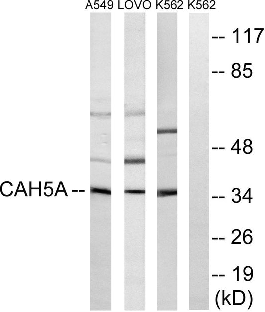 CA VA Rabbit Polyclonal Antibody
