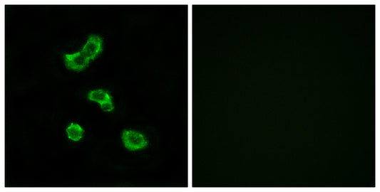 CA VB Rabbit Polyclonal Antibody