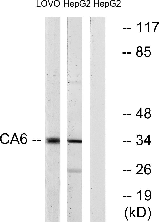 CA VI Rabbit Polyclonal Antibody
