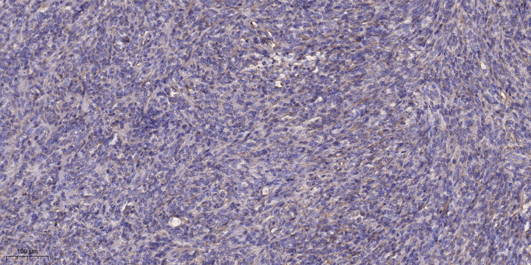 CA VIII Rabbit Polyclonal Antibody