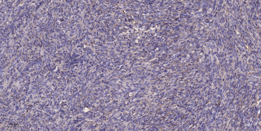 CA VIII Rabbit Polyclonal Antibody
