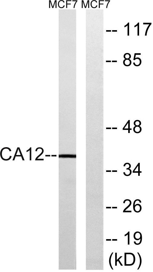 CA XII Rabbit Polyclonal Antibody