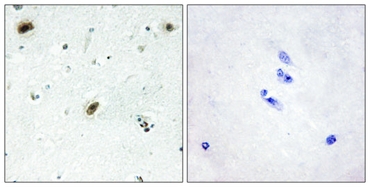 c-Abl Rabbit Polyclonal Antibody