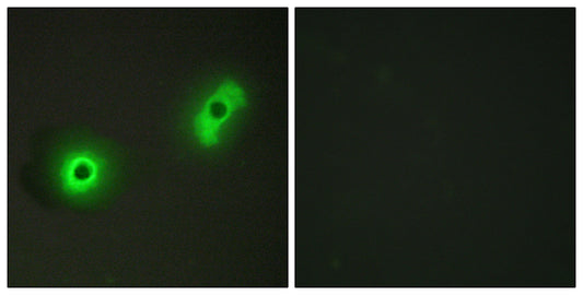 Cables2 Rabbit Polyclonal Antibody
