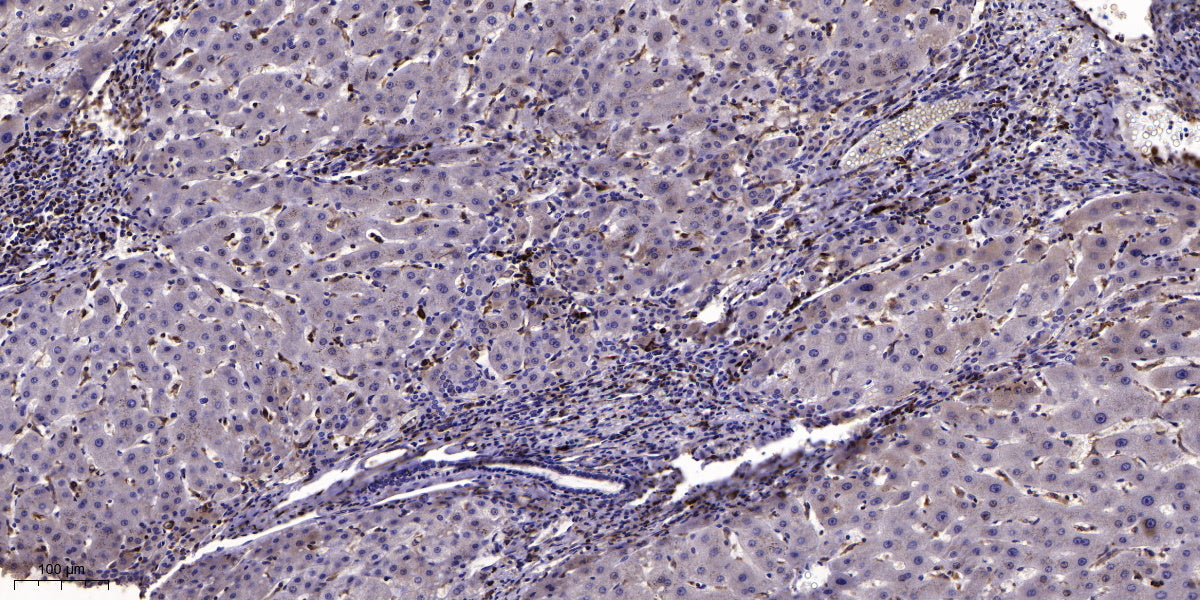 CAC1A Rabbit Polyclonal Antibody