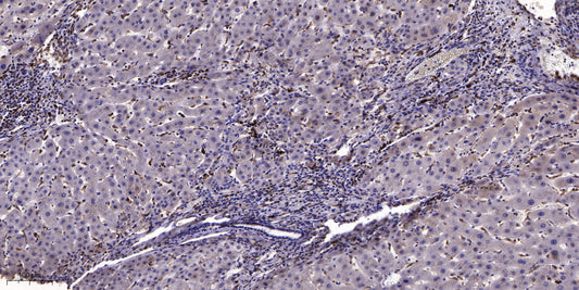 CAC1A Rabbit Polyclonal Antibody