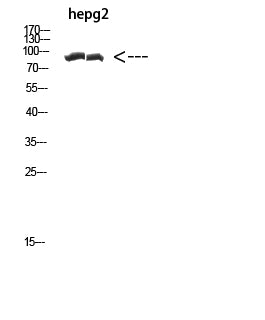 CACTIN Rabbit Polyclonal Antibody