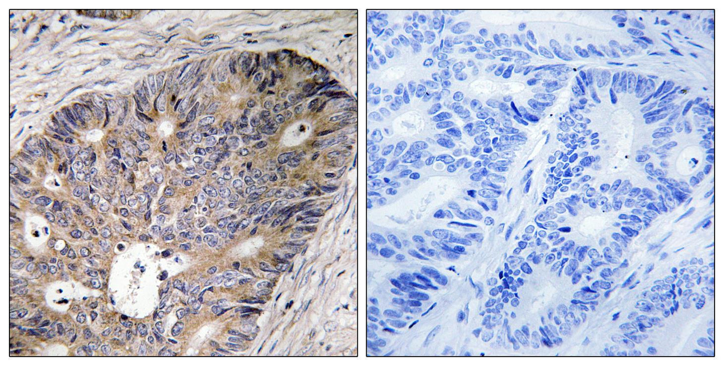CAD Rabbit Polyclonal Antibody