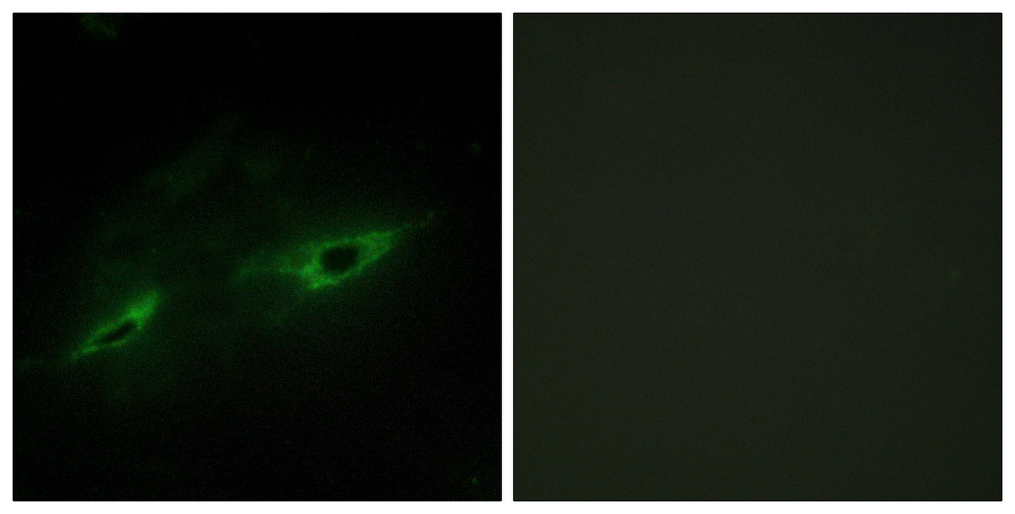 Cadherin-22 Rabbit Polyclonal Antibody
