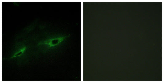 Cadherin-22 Rabbit Polyclonal Antibody