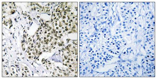 CAGE-1 Rabbit Polyclonal Antibody