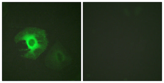 Caldesmon Rabbit Polyclonal Antibody