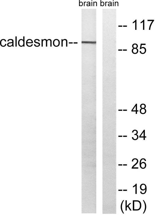 Caldesmon Rabbit Polyclonal Antibody