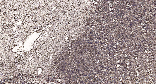 Calgizzarin Rabbit Polyclonal Antibody