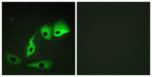Calmodulin Rabbit Polyclonal Antibody