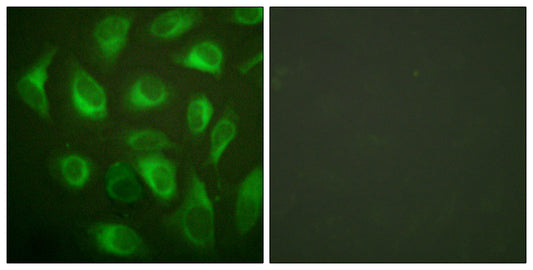 Calnexin Rabbit Polyclonal Antibody