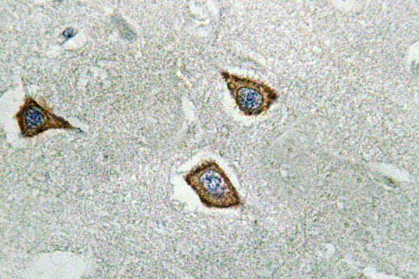 Calpain 2 Rabbit Polyclonal Antibody