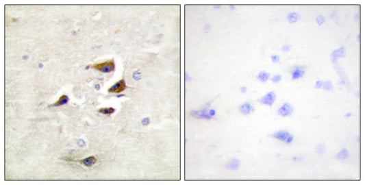 CaMKIIα/β/δ Rabbit Polyclonal Antibody