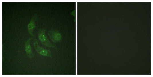 CaMKIV Rabbit Polyclonal Antibody