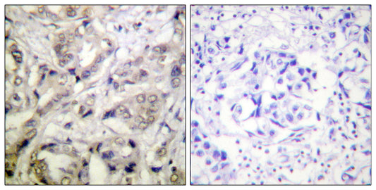 CaMKIα Rabbit Polyclonal Antibody