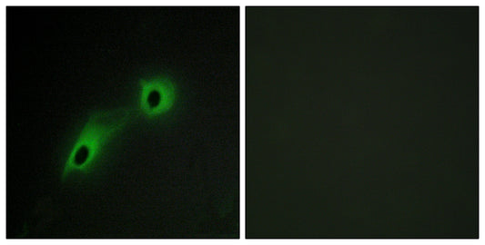 CaMKV Rabbit Polyclonal Antibody