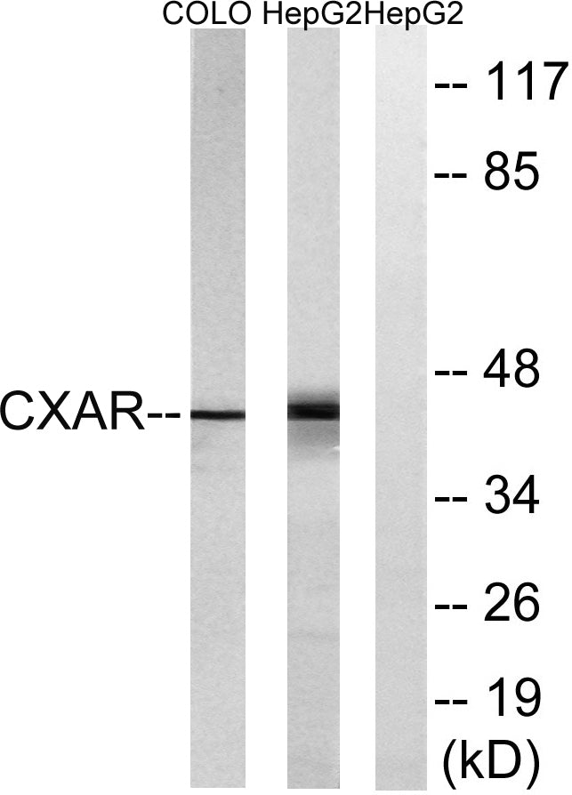 CAR Rabbit Polyclonal Antibody