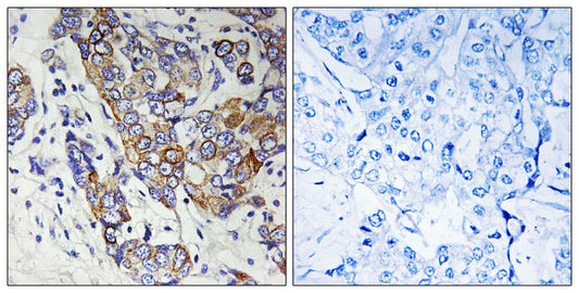 Carbonyl Reductase 1 Rabbit Polyclonal Antibody