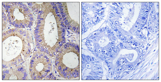 Carbonyl Reductase 3 Rabbit Polyclonal Antibody