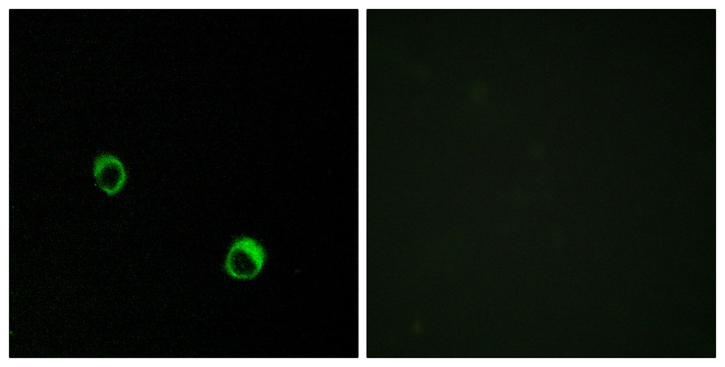 CARD 14 Rabbit Polyclonal Antibody
