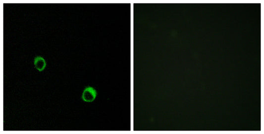 CARD 14 Rabbit Polyclonal Antibody