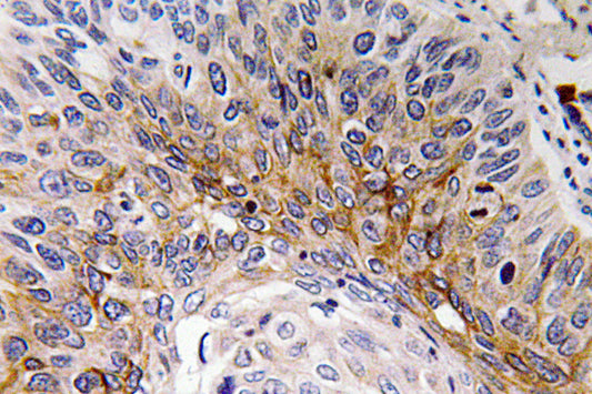 Cardiotrophin-1 Rabbit Polyclonal Antibody