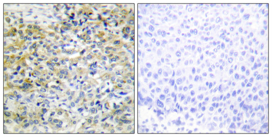 CARKL Rabbit Polyclonal Antibody