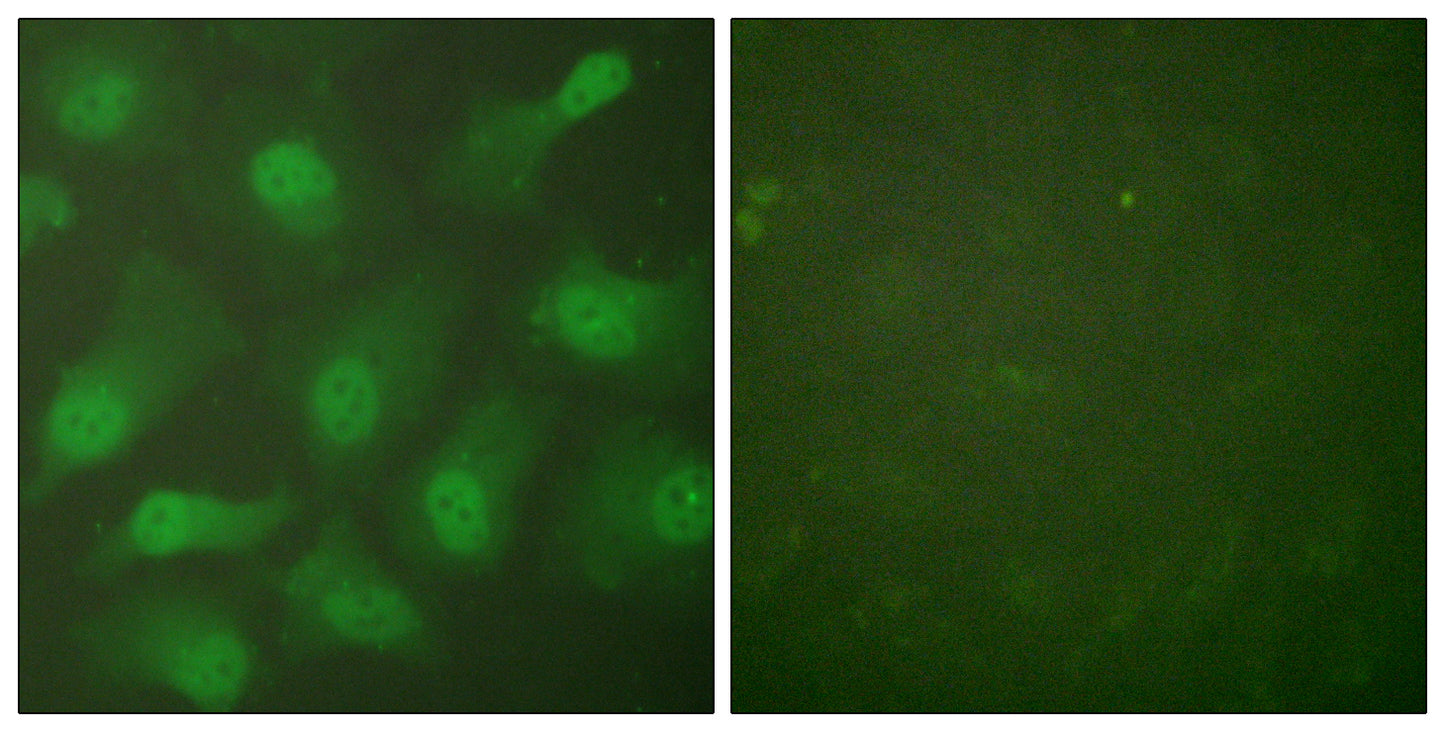 CAS Rabbit Polyclonal Antibody