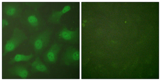 CAS Rabbit Polyclonal Antibody