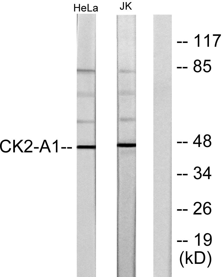 Casein Kinase IIα Rabbit Polyclonal Antibody